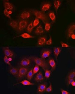 NDUFB8 Rabbit anti-Human, Mouse, Rat, Polyclonal, Novus Biologicals:Antibodies:Primary