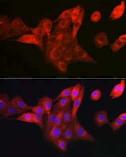 NDUFB8 Rabbit anti-Human, Mouse, Rat, Polyclonal, Novus Biologicals:Antibodies:Primary