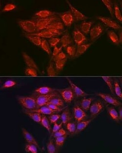 NDUFB8 Rabbit anti-Human, Mouse, Rat, Polyclonal, Novus Biologicals:Antibodies:Primary
