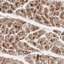 NDUFB8 Antibody, Novus Biologicals 25 &mu;L | Buy Online | Novus Biologicals | Fisher Scientific