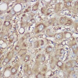 NDUFB8 Rabbit anti-Human, Mouse, Rat, Polyclonal, Novus Biologicals:Antibodies:Primary