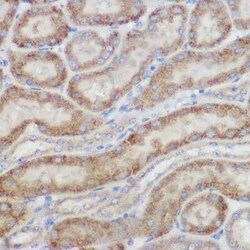 NDUFB8 Rabbit anti-Human, Mouse, Rat, Polyclonal, Novus Biologicals:Antibodies:Primary