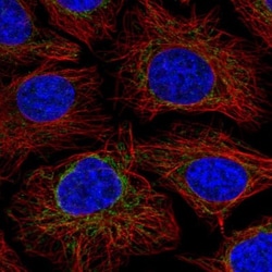 NDUFS2 Antibody, Novus Biologicals:Antibodies:Primary Antibodies