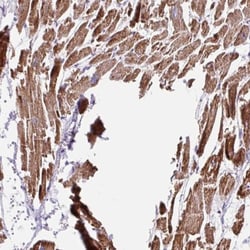 NDUFS2 Antibody, Novus Biologicals:Antibodies:Primary Antibodies