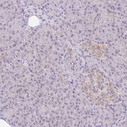 NDUFS2 Antibody, Novus Biologicals:Antibodies:Primary Antibodies
