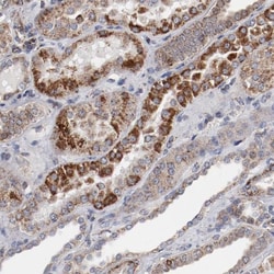 NDUFV2 Antibody, Novus Biologicals:Antibodies:Primary Antibodies