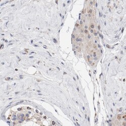 NDUFV2 Antibody, Novus Biologicals:Antibodies:Primary Antibodies