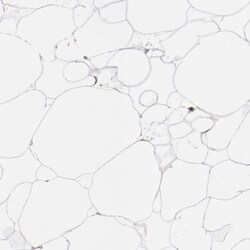 NDUFV2 Antibody, Novus Biologicals:Antibodies:Primary Antibodies