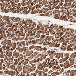 NDUFV2 Antibody, Novus Biologicals:Antibodies:Primary Antibodies