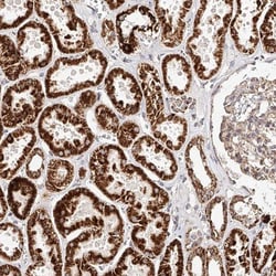 NDUFV3 Antibody, Novus Biologicals:Antibodies:Primary Antibodies