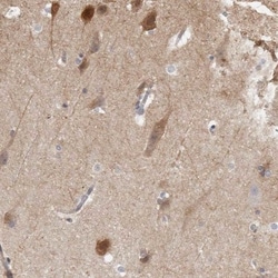 NECAB1 Antibody, Novus Biologicals 0.1mL; Unlabeled:Antibodies, Polyclonal