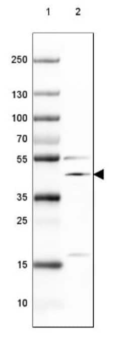 NECAB1 Antibody, Novus Biologicals 0.1mL; Unlabeled:Antibodies, Polyclonal