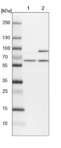 APPBP1 Antibody, Novus Biologicals 25 &mu;L, Unconjugated:Antibodies, Polyclonal