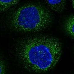 NEDL2 Antibody, Novus Biologicals 25 &mu;L | Buy Online | Novus Biologicals | Fisher Scientific