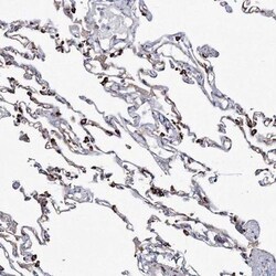 NEDL2 Antibody, Novus Biologicals 25 &mu;L | Buy Online | Novus Biologicals | Fisher Scientific