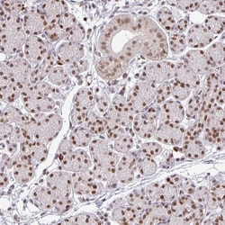 NEIL1 Antibody, Novus Biologicals:Antibodies:Primary Antibodies