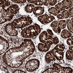 NEK1 Antibody, Novus Biologicals:Antibodies:Primary Antibodies