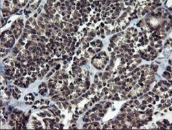 NEK11 Antibody (OTI5D9), Novus Biologicals 0.1mL; Unlabeled:Antibodies,