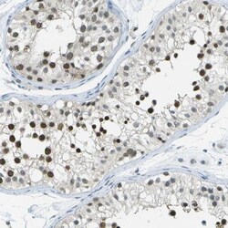 NEK11 Antibody, Novus Biologicals 0.1mL; Unlabeled:Antibodies, Polyclonal