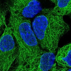 NEK3 Antibody, Novus Biologicals 0.1mL; Unlabeled:Antibodies, Polyclonal
