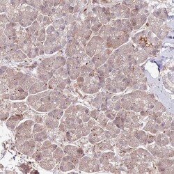 NEK3 Antibody, Novus Biologicals 0.1mL; Unlabeled:Antibodies, Polyclonal