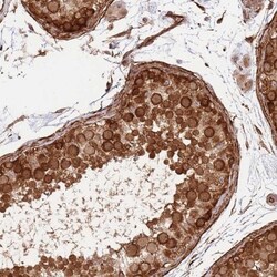 NEK3 Antibody, Novus Biologicals 0.1mL; Unlabeled:Antibodies, Polyclonal