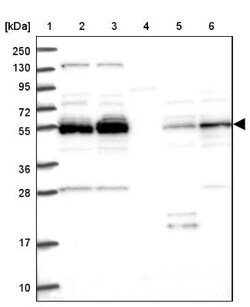 NEK3 Antibody, Novus Biologicals 0.1mL; Unlabeled:Antibodies, Polyclonal
