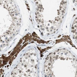 NEK4 Antibody, Novus Biologicals 0.1mL; Unlabeled:Antibodies, Polyclonal
