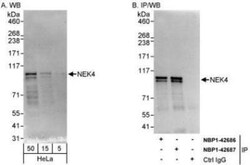 NEK4 Antibody, Novus Biologicals 0.1mL; Unlabeled:Antibodies, Polyclonal