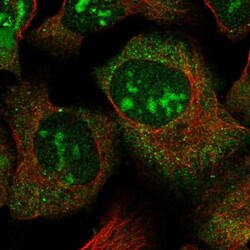 NEK5 Antibody, Novus Biologicals 0.1 mL | Buy Online | Novus Biologicals | Fisher Scientific