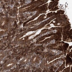 NEK5 Antibody, Novus Biologicals 0.1 mL | Buy Online | Novus Biologicals | Fisher Scientific