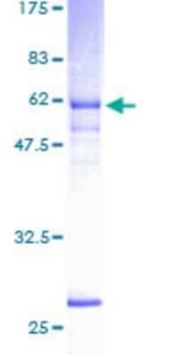 Novus Biologicals Recombinant Human NEK6 GST (N-Term) Protein 10 &mu;g | Buy Online | Novus Biologicals&trade; | Fisher Scientific