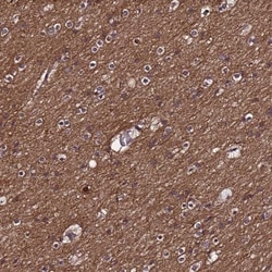 NELF Antibody, Novus Biologicals 0.1mL; Unlabeled:Antibodies, Polyclonal