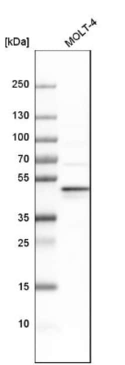 NELF-E Antibody, Novus Biologicals 25 &mu;L; Unlabeled:Antibodies, Polyclonal