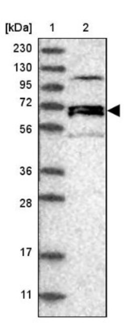 NET1 Antibody, Novus Biologicals 0.1mL; Unlabeled:Antibodies, Polyclonal