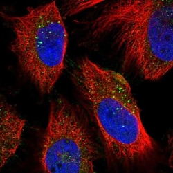 NEU-1/Sialidase-1 Antibody, Novus Biologicals 0.1mL; Unlabeled:Antibodies,