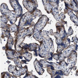 NEU-1/Sialidase-1 Antibody, Novus Biologicals 0.1mL; Unlabeled:Antibodies,
