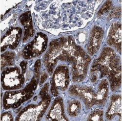 NEU-1/Sialidase-1 Antibody, Novus Biologicals 0.1mL; Unlabeled:Antibodies,