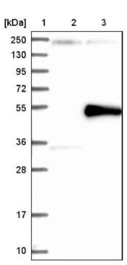NEU-1/Sialidase-1 Antibody, Novus Biologicals 25 &mu;L; Unlabeled:Anticorps,