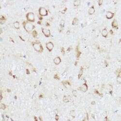NEURL1B Rabbit anti-Human, Mouse, Rat, Polyclonal, Novus Biologicals 20 &mu;g | Buy Online | Novus Biologicals | Fisher Scientific