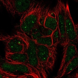NF-H Antibody, Novus Biologicals 0.1mL; Unlabeled:Antibodies, Polyclonal