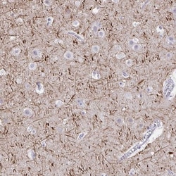 NF-H Antibody, Novus Biologicals 0.1mL; Unlabeled:Antibodies, Polyclonal