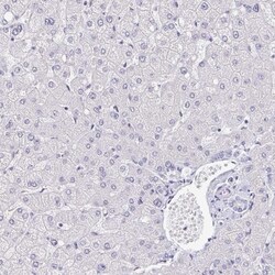NF-H Antibody, Novus Biologicals 0.1mL; Unlabeled:Antibodies, Polyclonal
