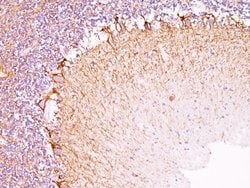 Mouse anti-NF-H, Clone: NF421 + NFL/736, Novus Biologicals 0.2mg; Unlabeled:Antibodies,