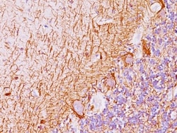 Mouse anti-NF-H, Clone: NF421 + NFL/736, Novus Biologicals 0.2mg; Unlabeled:Antibodies,