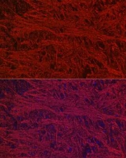 NF-L Rabbit anti-Human, Mouse, Rat, Clone: 3L9Y10, Novus Biologicals 20