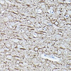NF-L Rabbit anti-Human, Mouse, Rat, Clone: 3L9Y10, Novus Biologicals 20