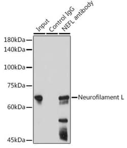 NF-L Rabbit anti-Human, Mouse, Rat, Clone: 3L9Y10, Novus Biologicals 20