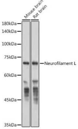 NF-L Rabbit anti-Human, Mouse, Rat, Clone: 3L9Y10, Novus Biologicals 20