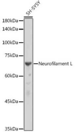 NF-L Rabbit anti-Human, Mouse, Rat, Clone: 3L9Y10, Novus Biologicals 20
